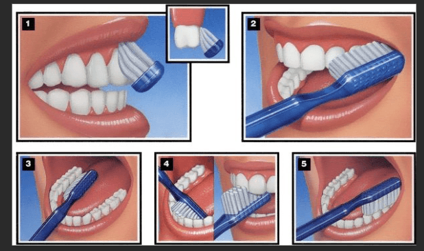 Brushing Techniques