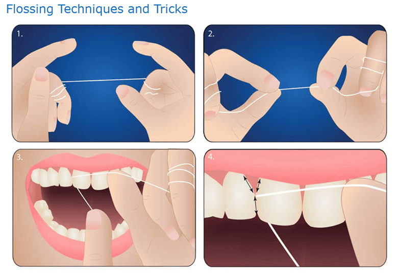 Flossing Techniques